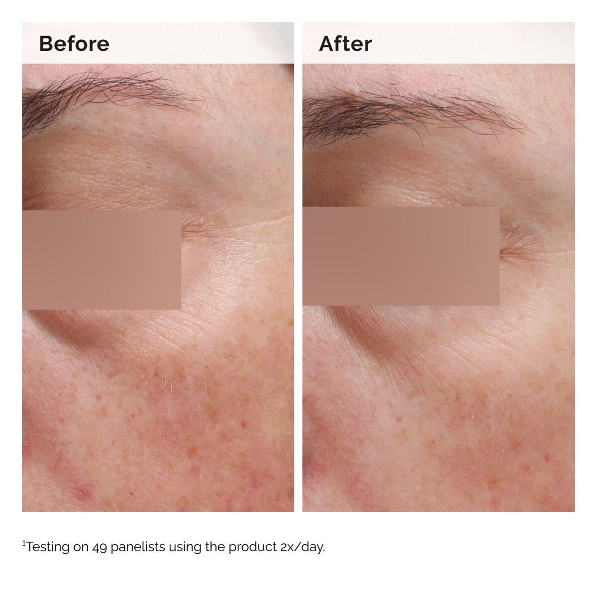 niacinamide-5-face-and-body-emulsion-z2 2024-08-23-ORD-Nia-5pct-Face-Body-B-A-Elasticity-Global-02-1x1.jpg