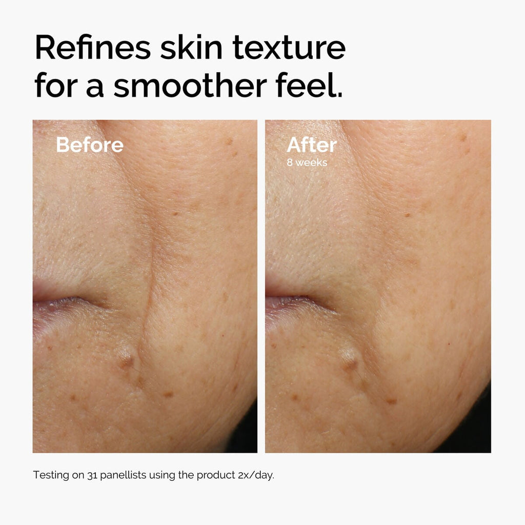 caffeine-3-escin-1-face-serum-o6 ord-caffeine-3pct-escin-1pct-face-serum-before-after-texture.jpg