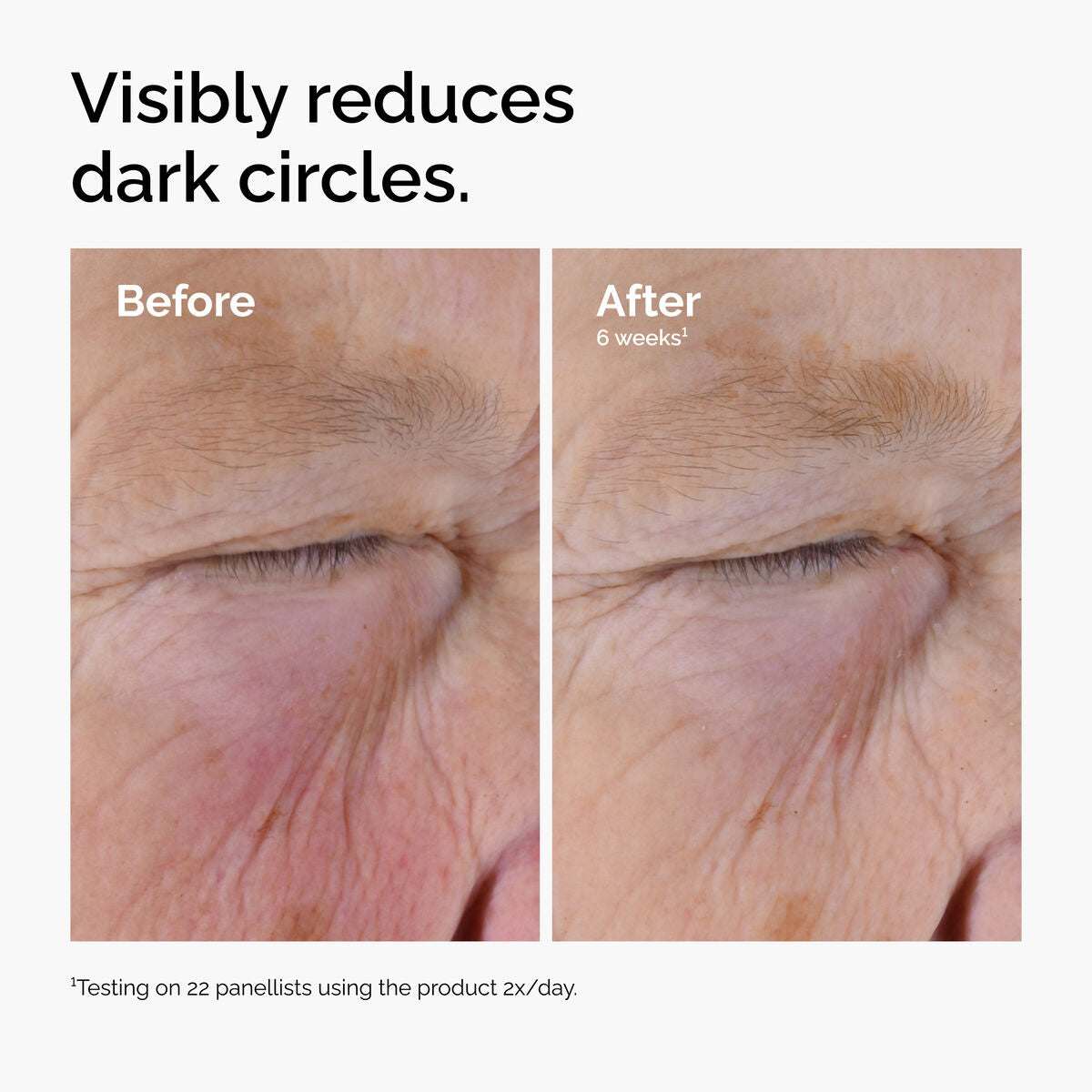 caffeine-solution-5-egcg-eye-serum-p4 ord-caffeine-solution-egcg-dark-circles-before-after.jpg