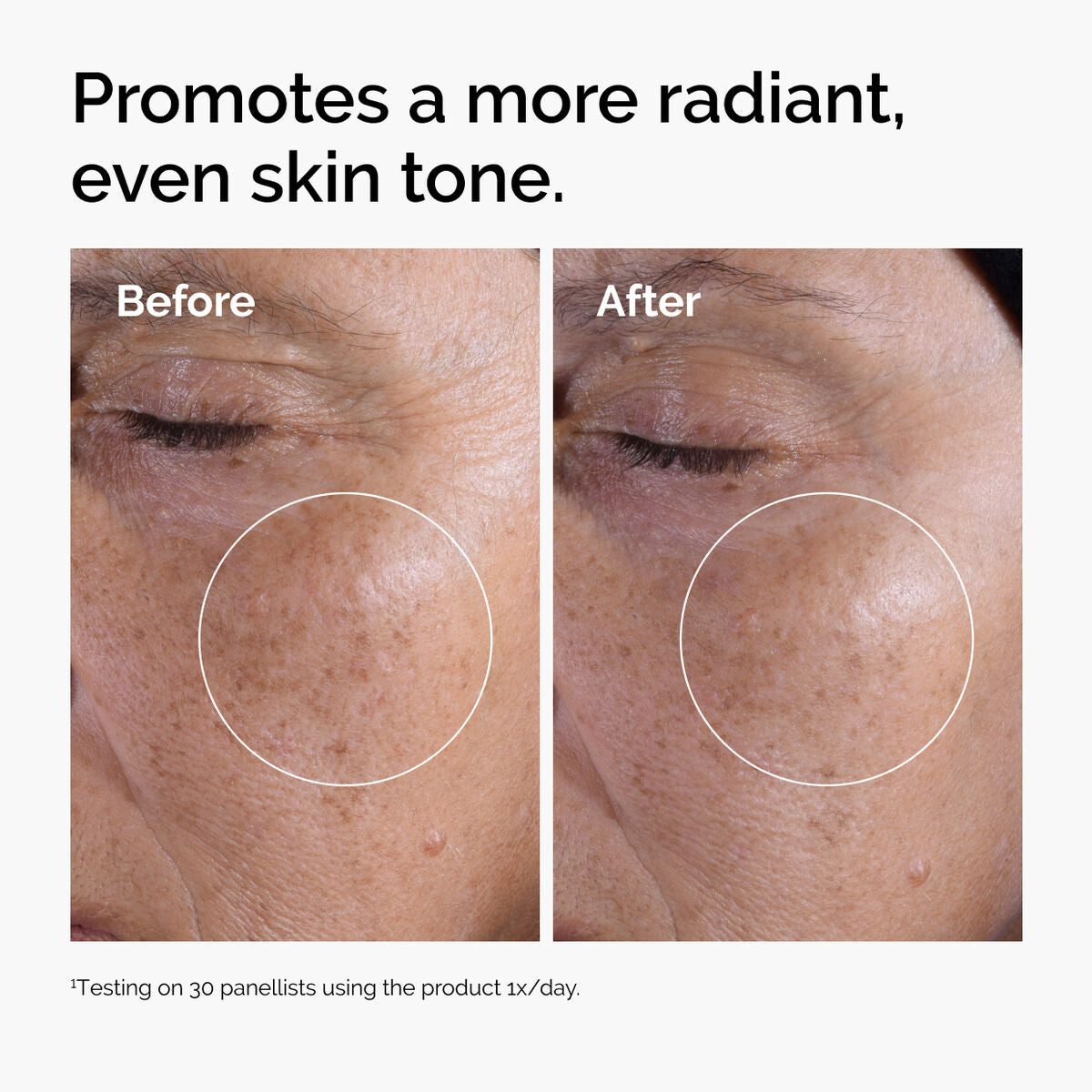glycolic-acid-7-exfoliating-toner-z9 ord-glycolic-before-after-radiance.jpg