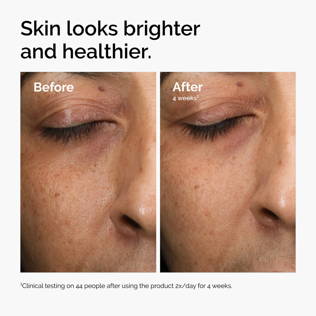 multi-antioxidant-radiance-serum-u3 ord-mars-before-after-healthy.jpg