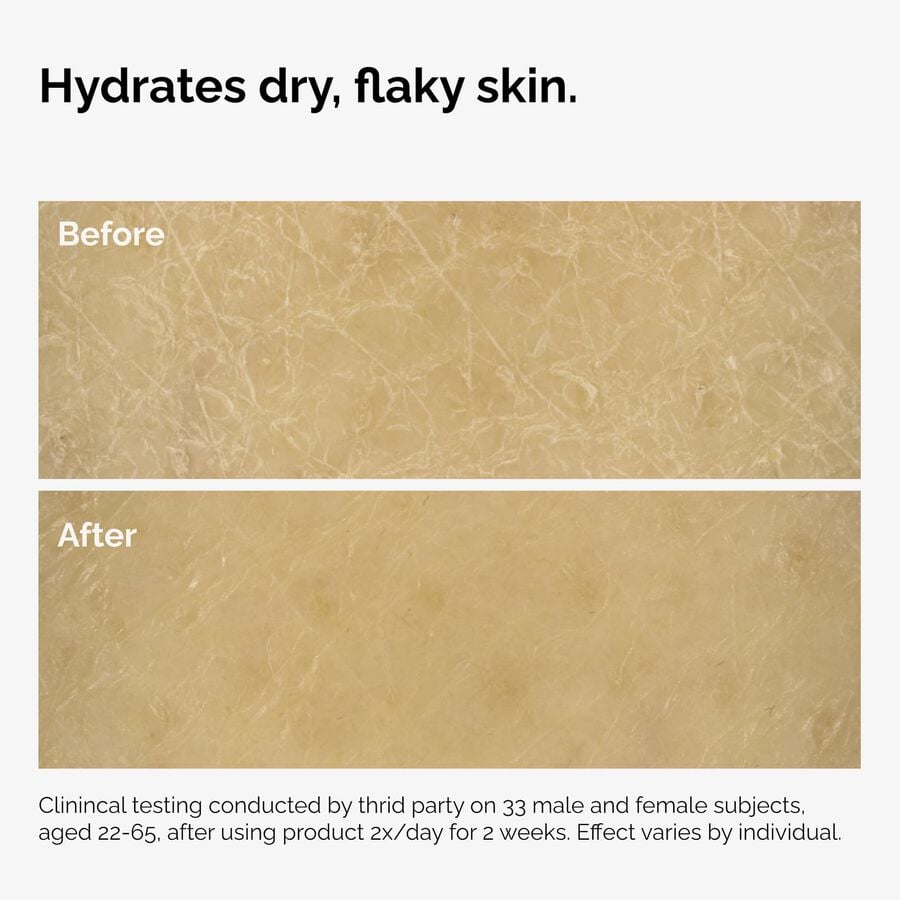 the-body-care-collection-b9 ord-natural-moisturizing-factors-inulin-body-before-after-graphic-02.jpg