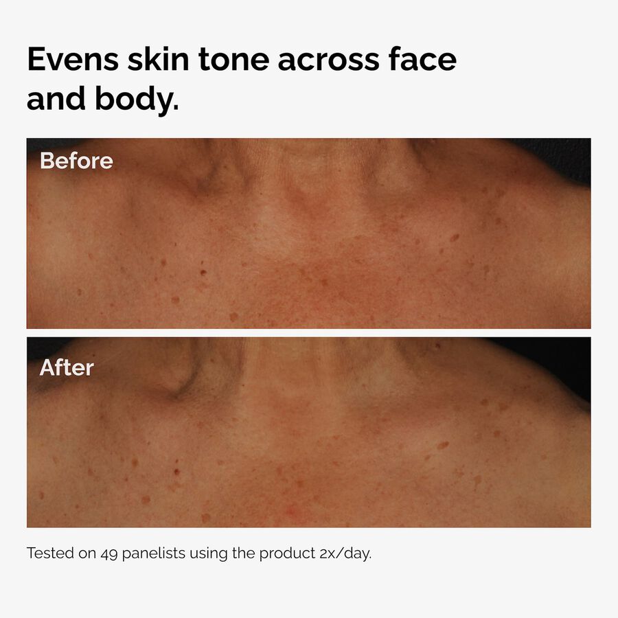 the-body-care-collection-b9 ord-niacinamide-face-body-serum-before-after-even-tone-graphic.jpg