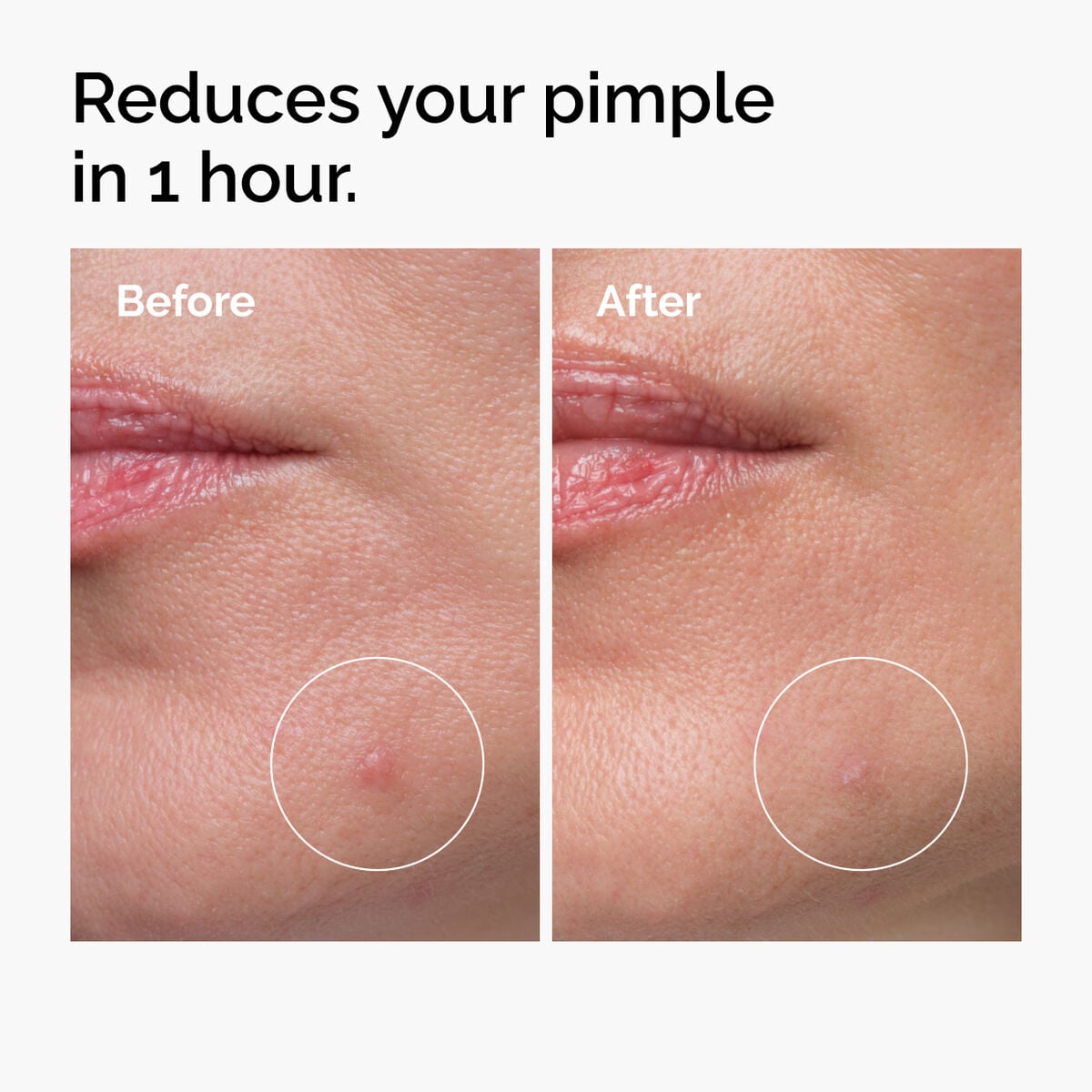 sulfur-10-powder-to-cream-concentrate-h3 ord-sulfur-10pct-powder-to-cream-concentrate-before-after-NA.jpg