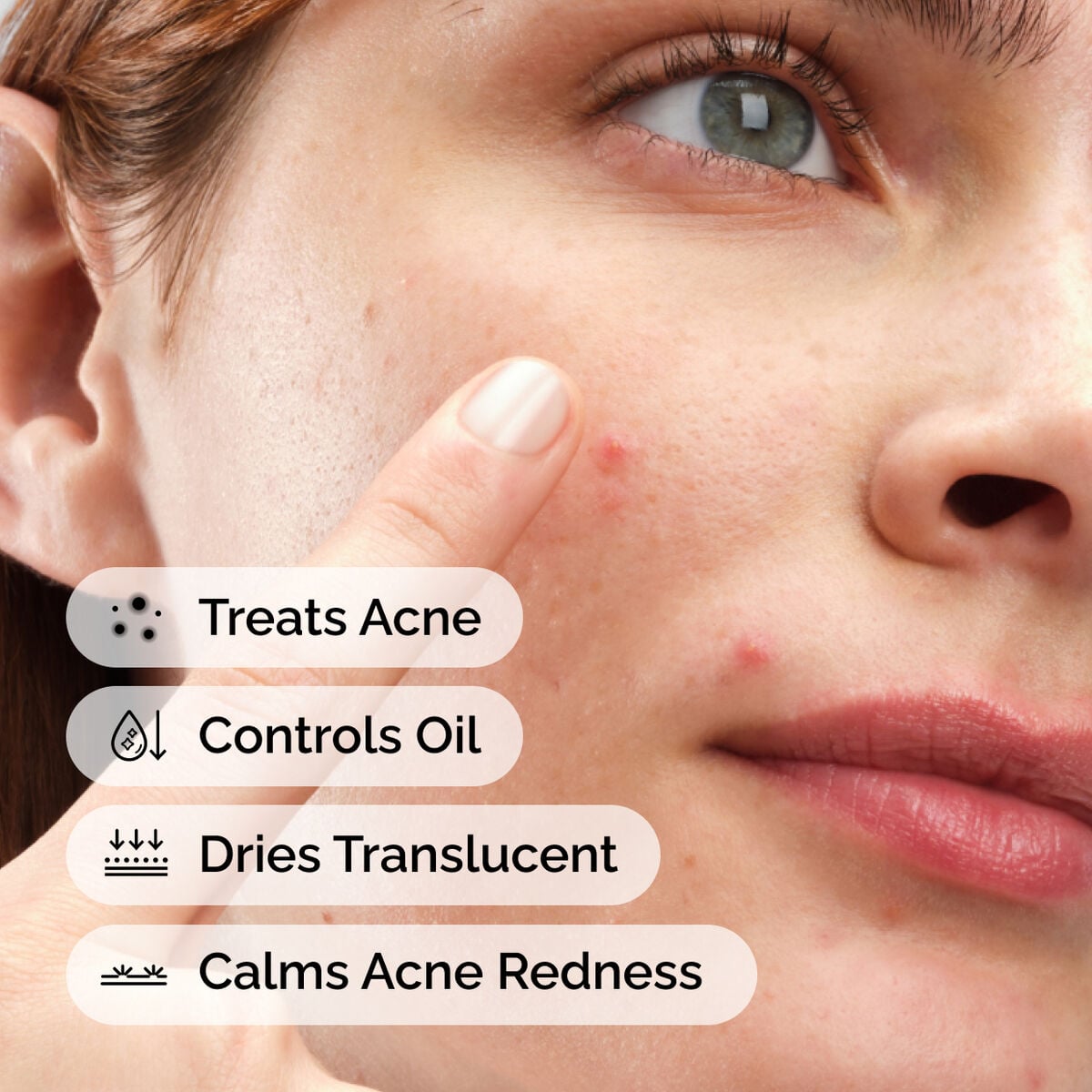 sulfur-10-powder-to-cream-concentrate-h3 ord-sulfur-10pct-powder-to-cream-concentrate-model-application-with-benefits-acne.jpg
